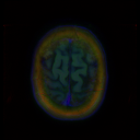MRI Input